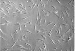 Fibroblastes gingivaux au microscope optique 